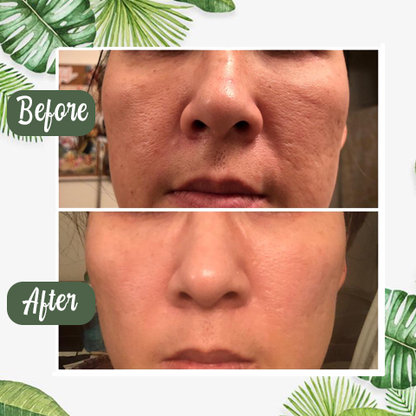 Safeorigs™  100% Natural Green Tea Deep Cleanse Mask