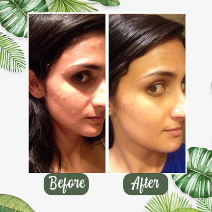 Safeorigs™  100% Natural Green Tea Deep Cleanse Mask