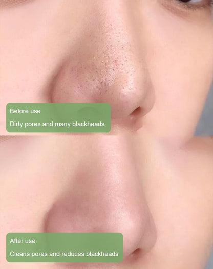 Safeorigs™  100% Natural Green Tea Deep Cleanse Mask