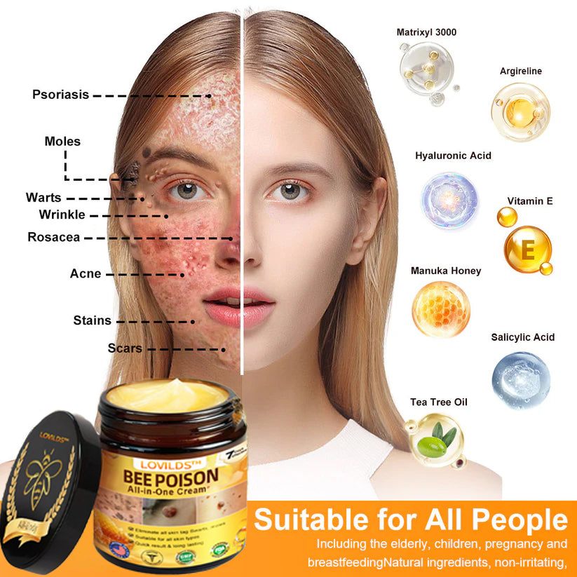[𝐎𝐟𝐟𝐢𝐜𝐢𝐚𝐥 𝐁𝐫𝐚𝐧𝐝 𝐒𝐭𝐨𝐫𝐞] 🐝 LOVILDS™ 𝐁𝐞𝐞 𝐕𝐞𝐧𝐨𝐦 𝐀𝐥𝐥-𝐢𝐧-𝐎𝐧𝐞 𝐂𝐫𝐞𝐚𝐦 (👩‍⚕️ 𝐀𝐦𝐞𝐫𝐢𝐜𝐚𝐧 𝐀𝐜𝐚𝐝𝐞𝐦𝐲 𝐨𝐟 𝐃𝐞𝐫𝐦𝐚𝐭𝐨𝐥𝐨𝐠𝐲 𝟐𝟎𝟐𝟓 𝐒𝐩𝐞𝐜𝐢𝐚𝐥𝐥𝐲 𝐑𝐞𝐜𝐨𝐦𝐦𝐞𝐧𝐝𝐞𝐝 𝐏𝐫𝐨𝐝𝐮𝐜𝐭)👩‍⚕️
