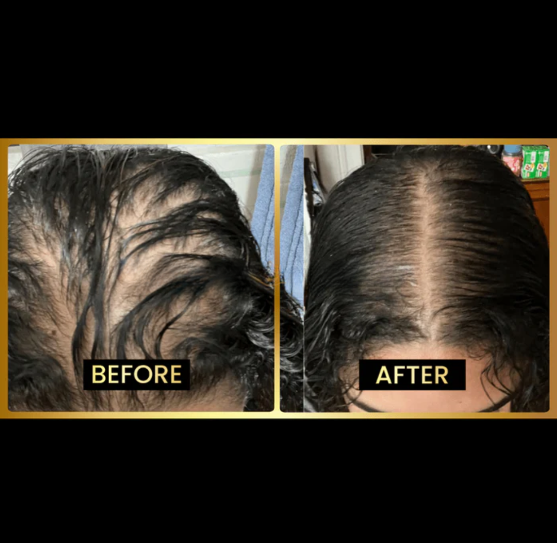 ✨HOT SALE 50% OFF🔥 Scalp Stimulator | Hair Growth Serum Oil