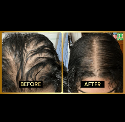 ✨HOT SALE 50% OFF🔥 Scalp Stimulator | Hair Growth Serum Oil