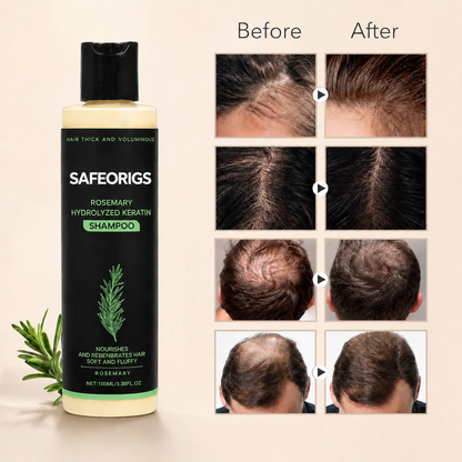⚡ FINAL HOURS - SAVE 70% 🌿 Safeorigs Hair Growth Formula
